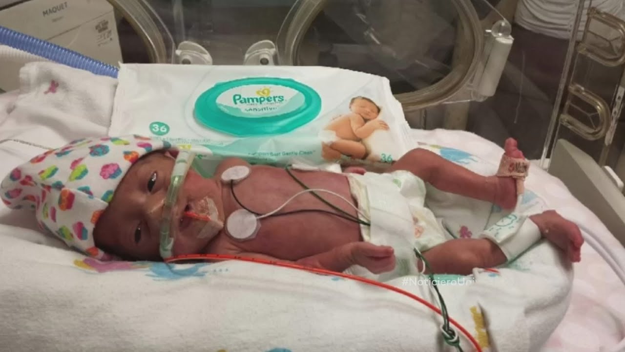 bebe de 6 meses prematuro