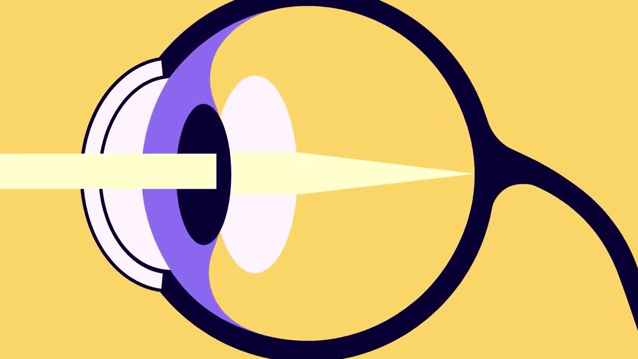 centro de la vision en el cerebro