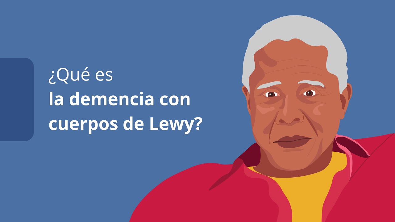 como prevenir la demencia de cuerpos de lewy