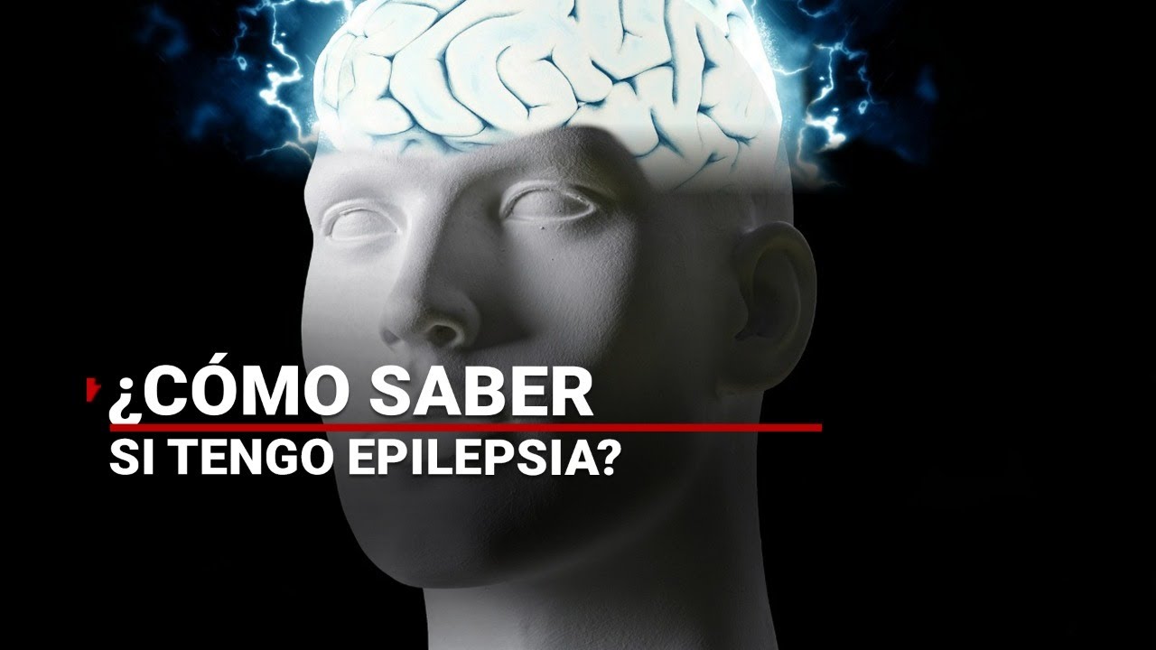 como saber si te va a dar un ataque epiléptico