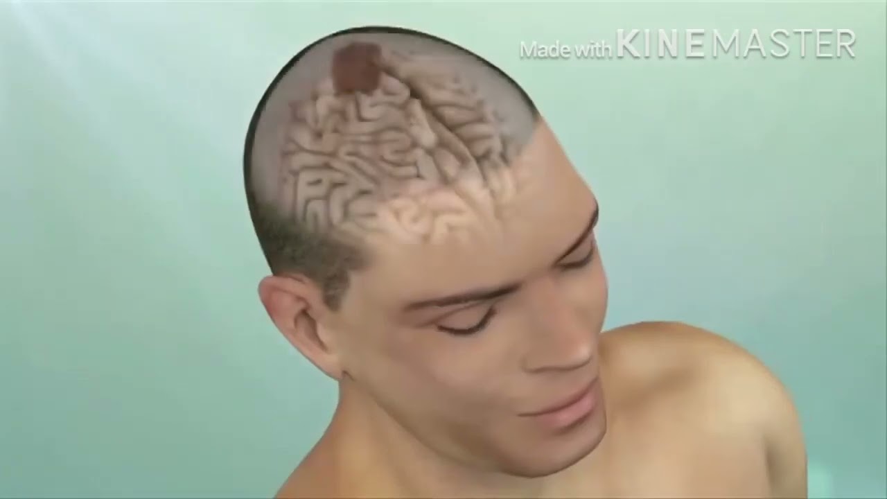 como saber si tienes algo malo en la cabeza