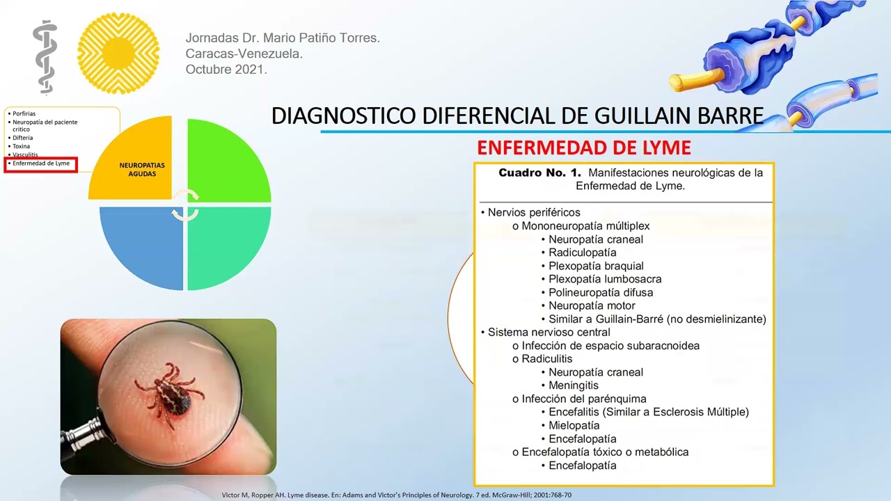 diagnostico diferencial sindrome de guillain barre