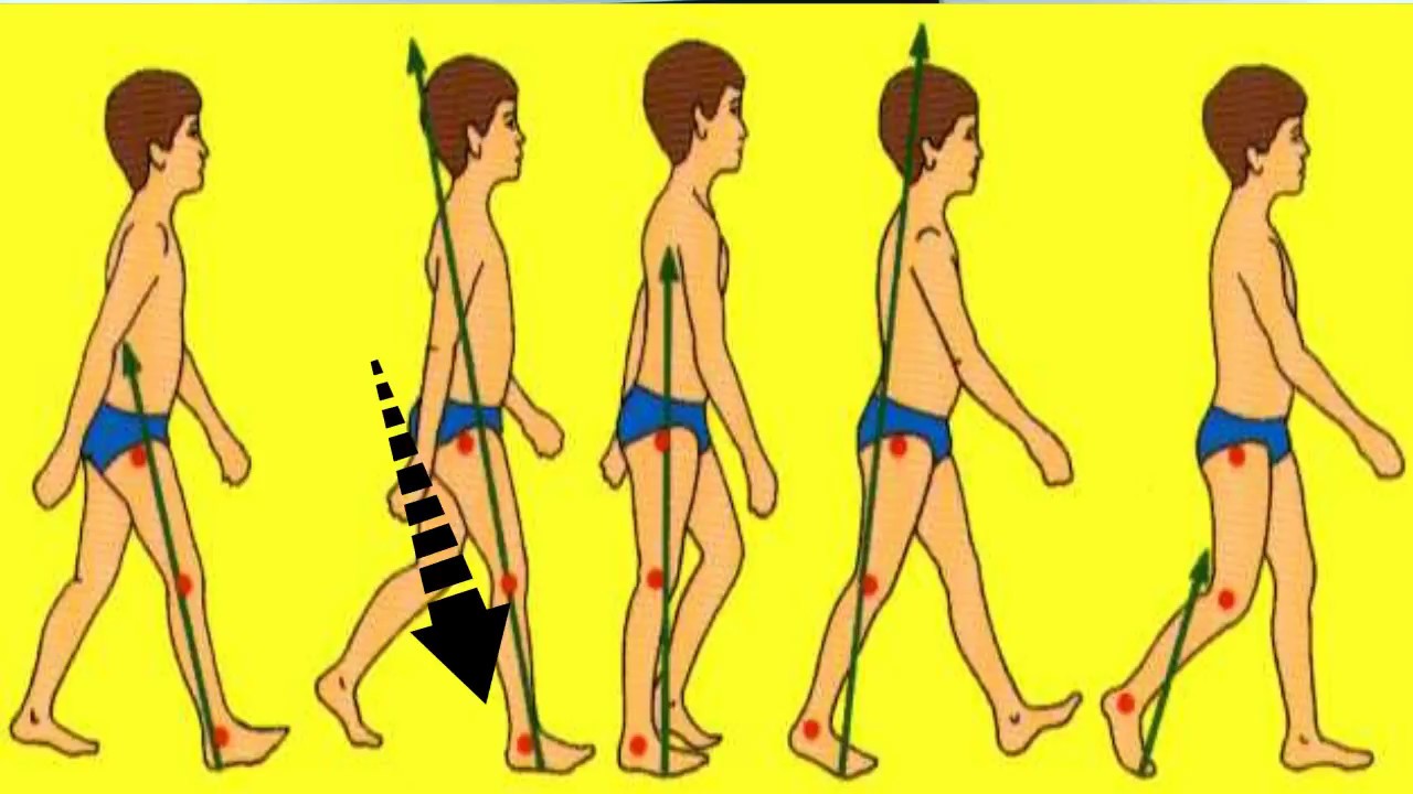 fases de la marcha en fisioterapia