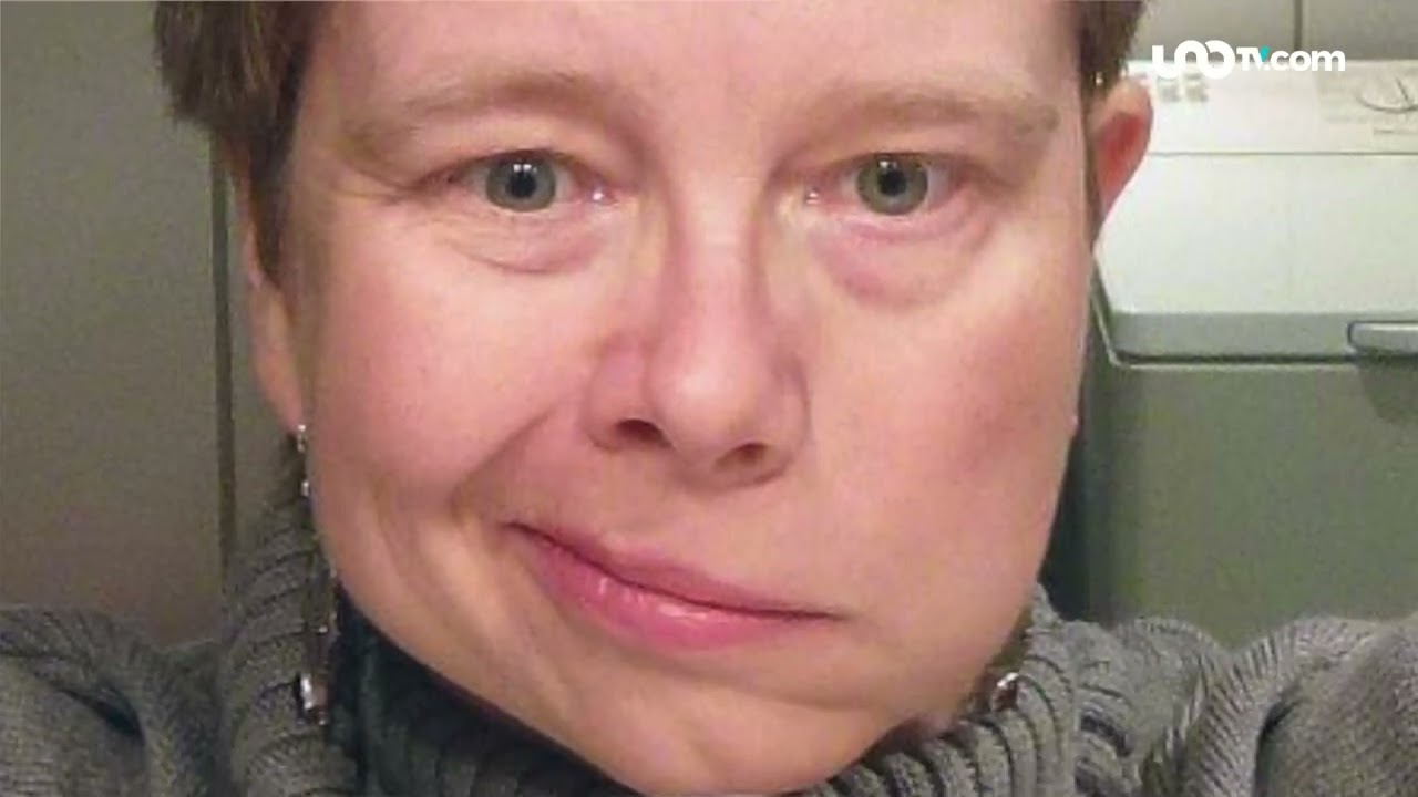 porque siento la mitad de la cara dormida