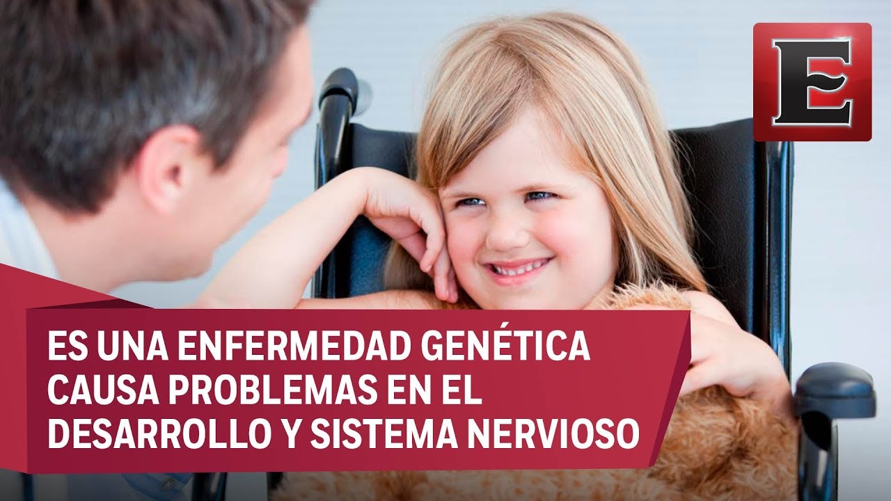 que es el sindrome de rett