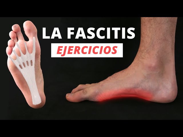 tengo pie plano y me duelen los pies