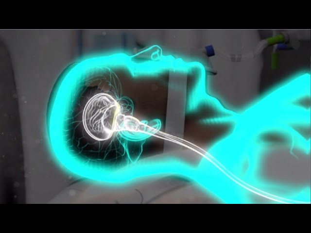 una persona en coma puede moverse