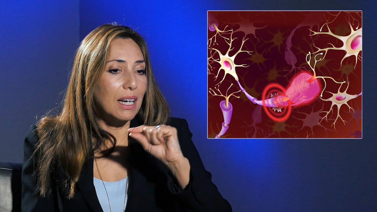 síntomas de esclerosis multiple como se diagnostica