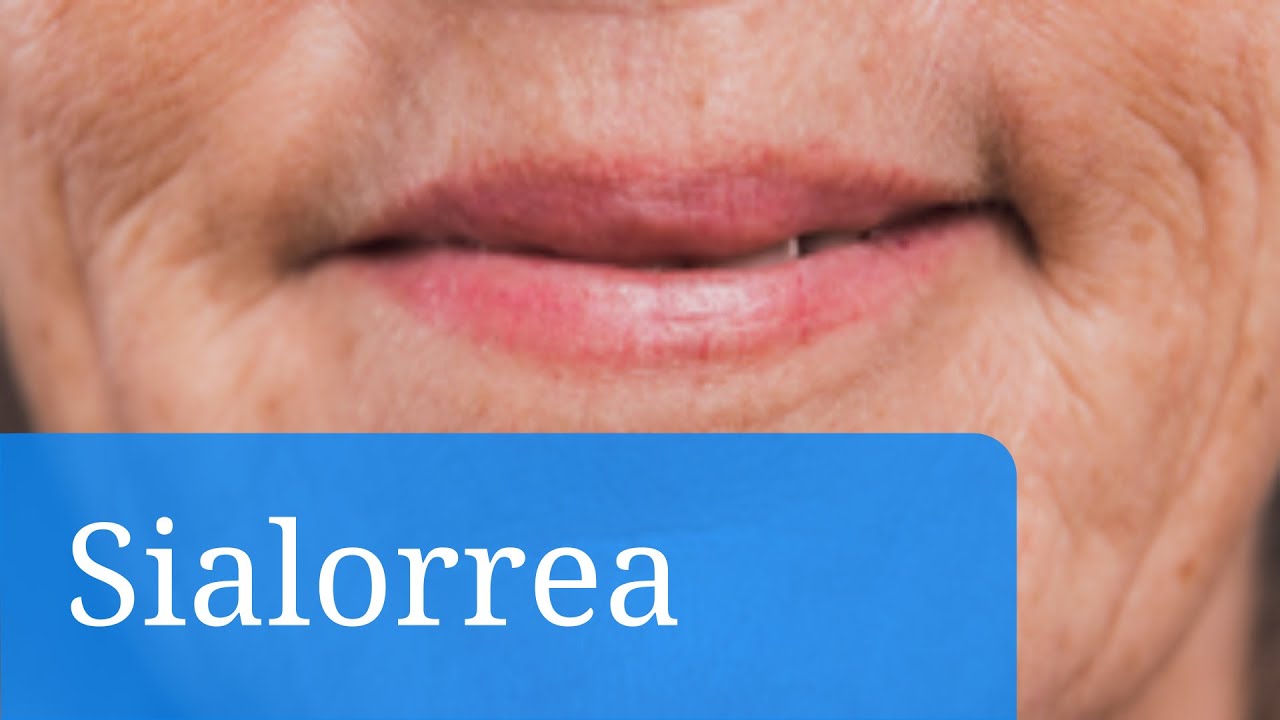 tratamiento para la sialorrea en adultos