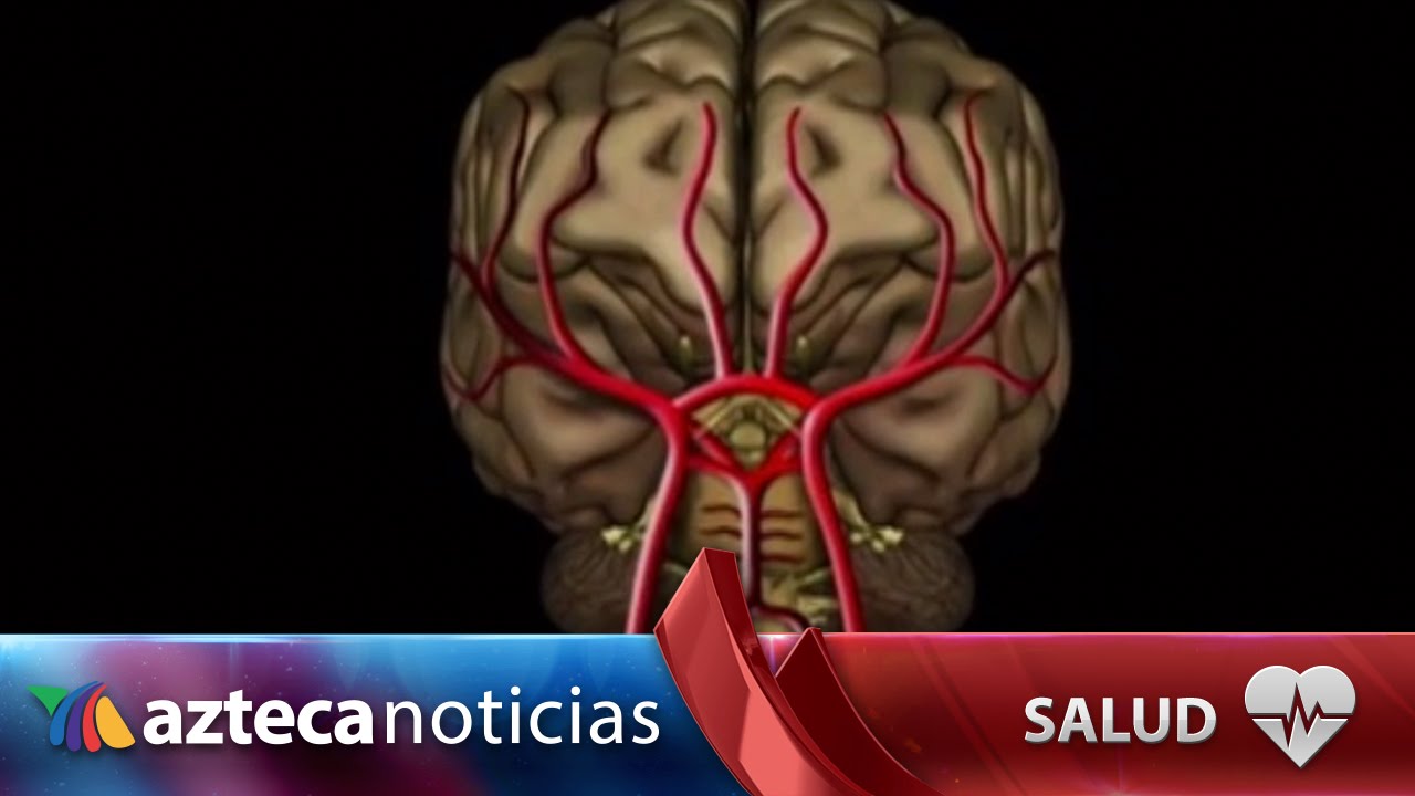 una embolia cerebral puede causar la muerte