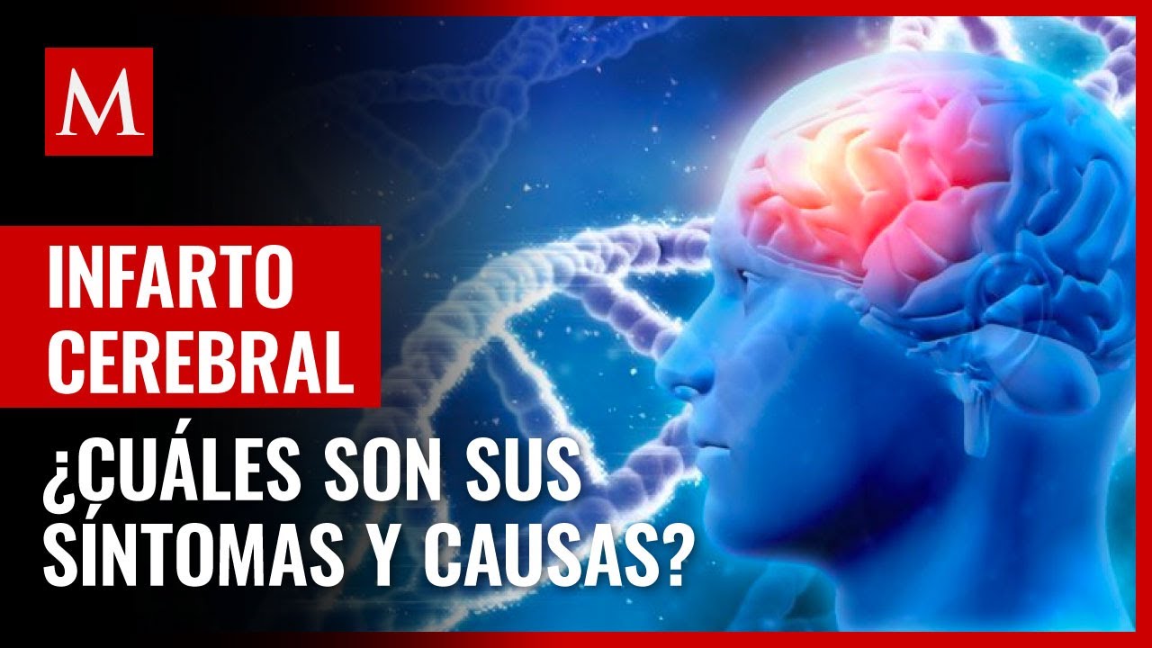 a que se debe el infarto cerebral