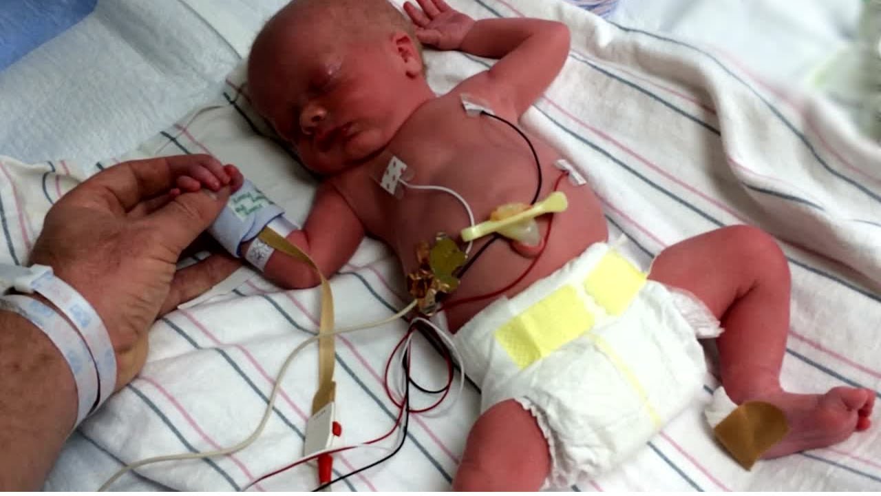 bebe 37 semanas é prematuro