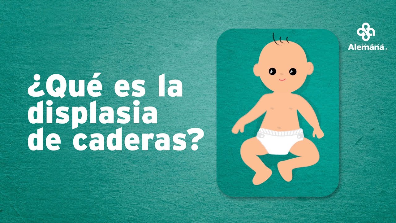 causas de la displasia de cadera