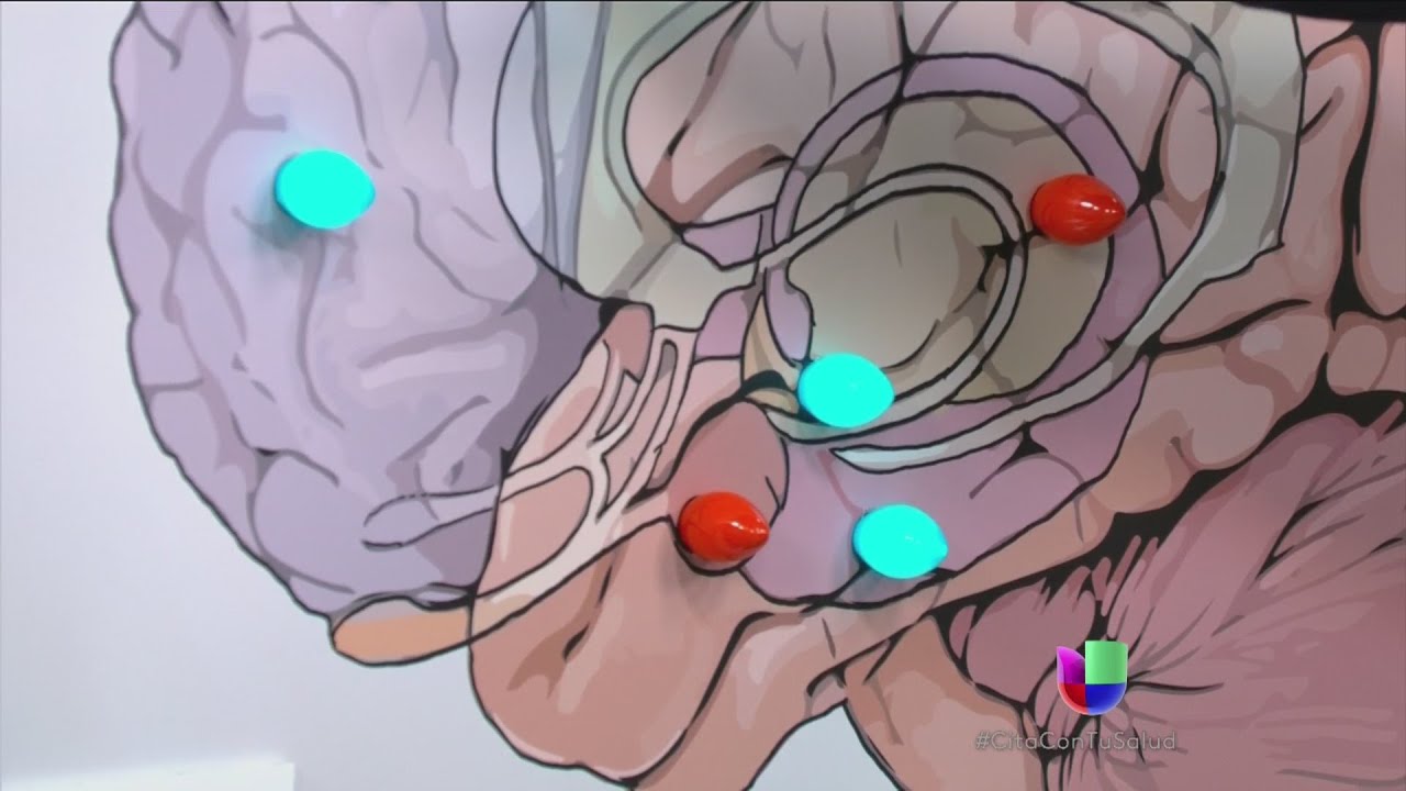 cerebro de una persona con depresion