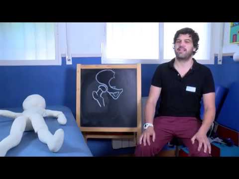 displasia de cadera en adultos tratamiento fisioterapeutico
