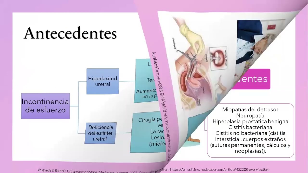 fisiopatologia de la incontinencia urinaria en el adulto mayor