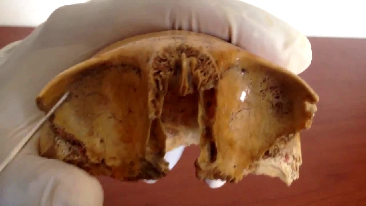 huesos de la cara frontal
