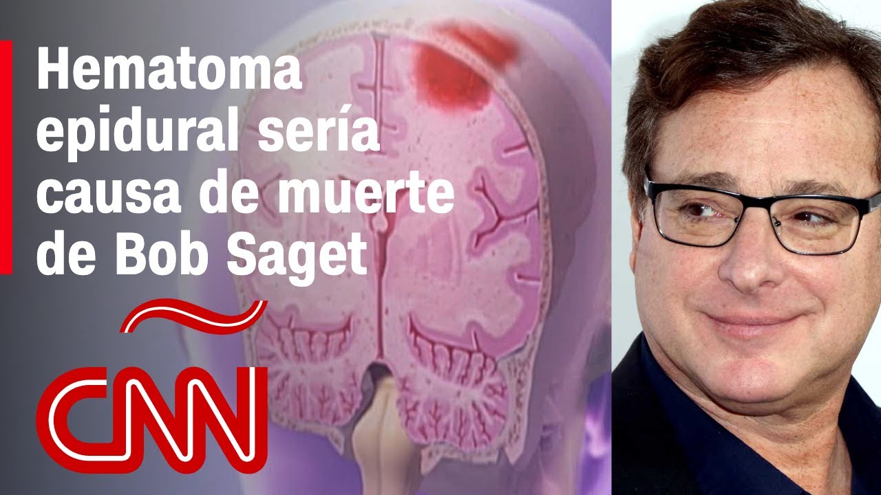 muerte por golpe en la cabeza