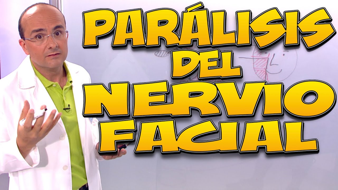 paralisis facial causas sintomas y tratamiento
