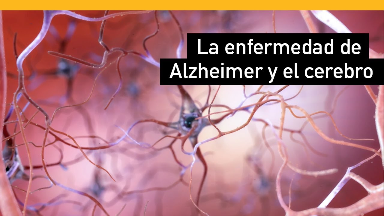 parkinson y alzheimer a la vez
