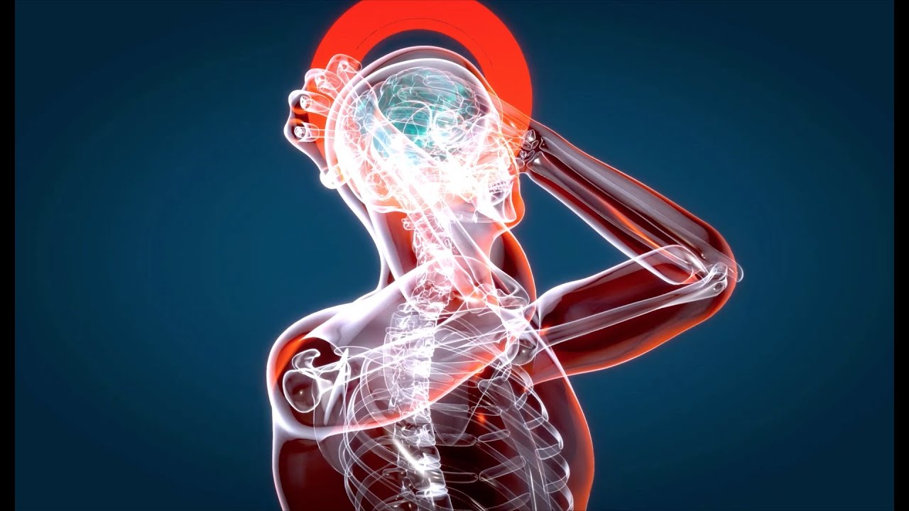 porque se produce el aneurisma cerebral