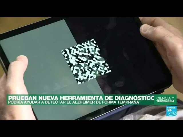 pruebas para saber si tendré alzheimer