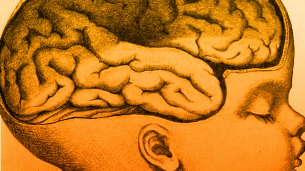 que es paralisis cerebral en niños