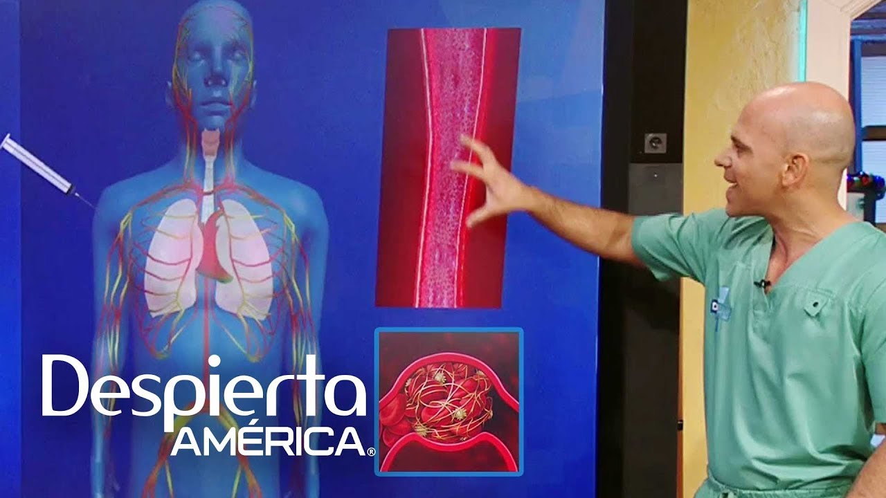 que es un coagulo de sangre