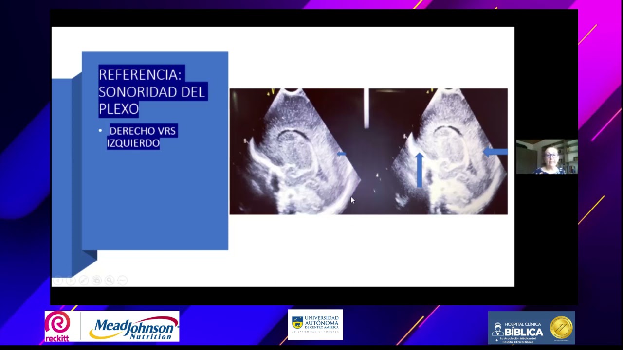 signos de leucomalacia periventricular en adultos