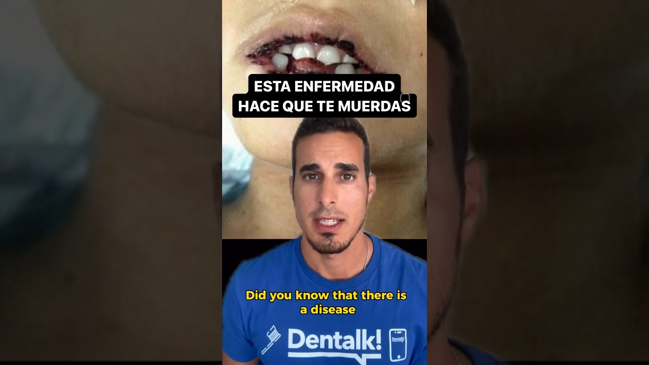 sindrome de lesch nyhan esperanza de vida