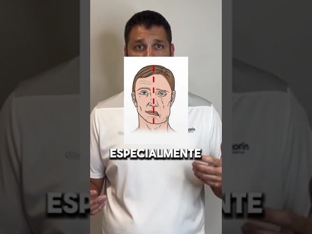 sintomas de ictus en los ojos