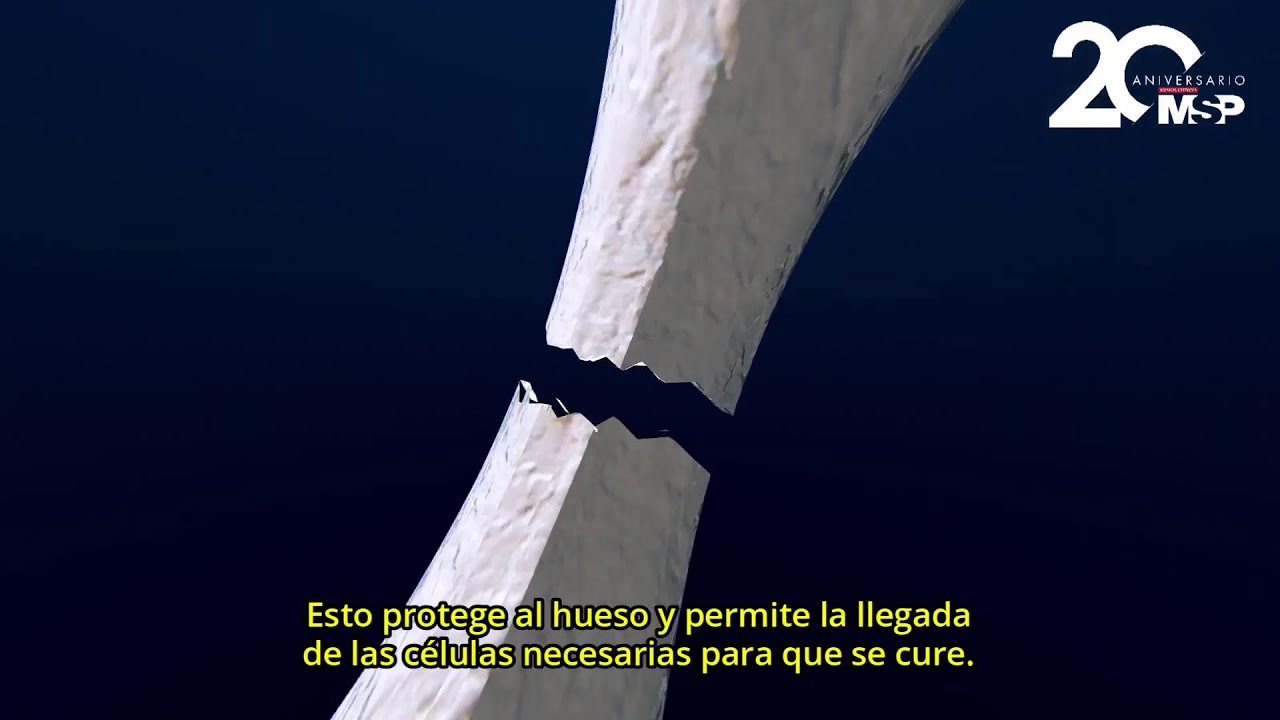 cuanta fuerza se necesita para romper un hueso