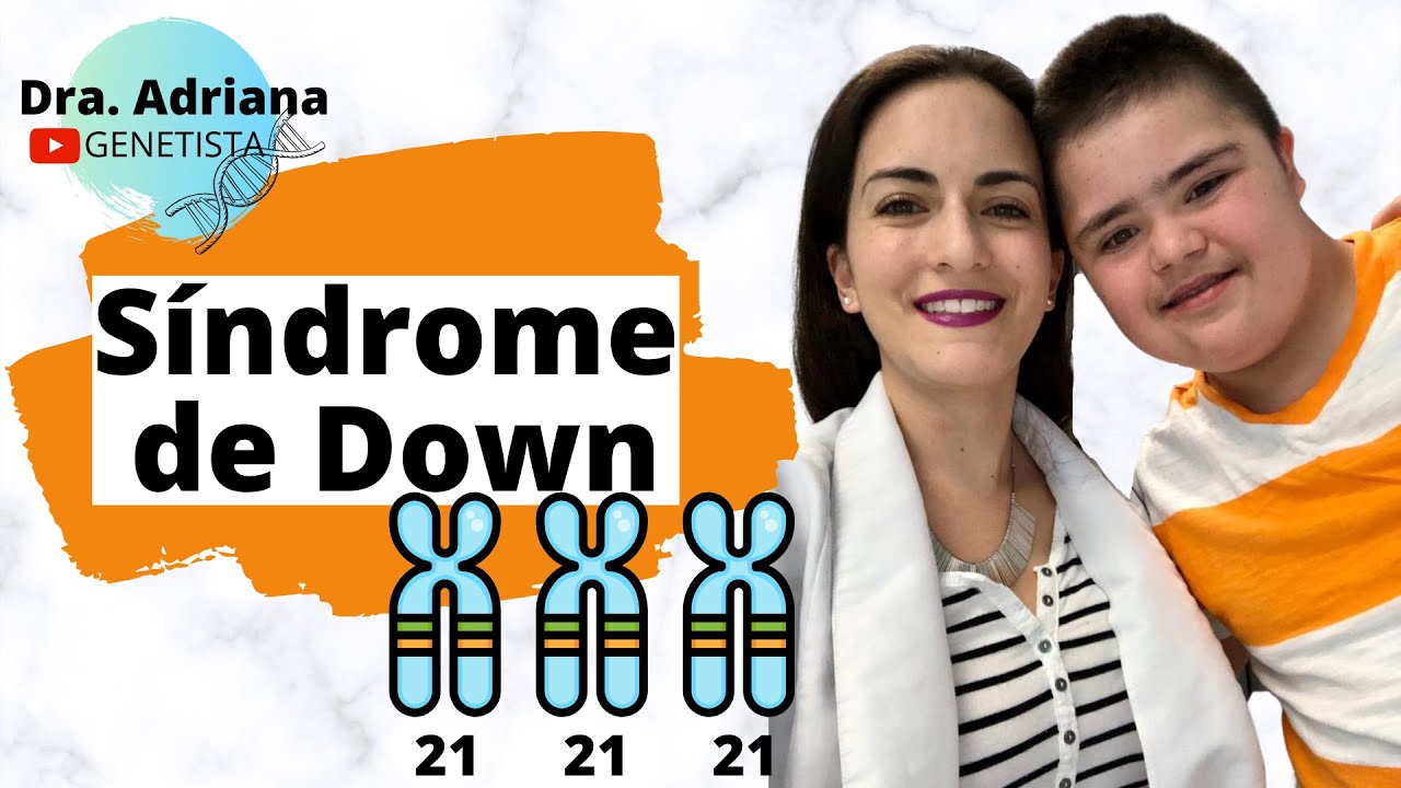 que piensa la gente sobre el sindrome de down